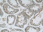 MEX3C Antibody in Immunohistochemistry (Paraffin) (IHC (P))