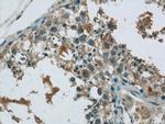 MEX3C Antibody in Immunohistochemistry (Paraffin) (IHC (P))