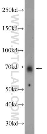 MEX3C Antibody in Western Blot (WB)