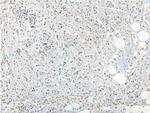 LMTK3 Antibody in Immunohistochemistry (Paraffin) (IHC (P))