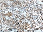 LMTK3 Antibody in Immunohistochemistry (Paraffin) (IHC (P))