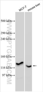 LMTK3 Antibody in Western Blot (WB)