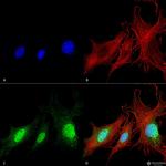 BNIP3 Antibody in Immunocytochemistry (ICC/IF)