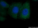 SHE Antibody in Immunocytochemistry (ICC/IF)