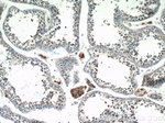 SHE Antibody in Immunohistochemistry (Paraffin) (IHC (P))