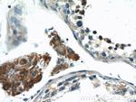 SHE Antibody in Immunohistochemistry (Paraffin) (IHC (P))