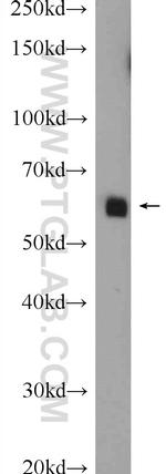 SHE Antibody in Western Blot (WB)
