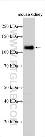 Nephrin Antibody in Western Blot (WB)