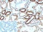 PLA2R1/Phospholipase A2 Receptor 1 Monoclonal Antibody (PLA2R1/4891)