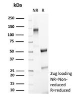 PLA2R1/Phospholipase A2 Receptor 1 Antibody in SDS-PAGE (SDS-PAGE)