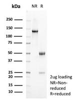 PLA2R1/Phospholipase A2 Receptor 1 Antibody in SDS-PAGE (SDS-PAGE)