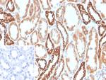 PLA2R1/Phospholipase A2 Receptor 1 Monoclonal Antibody (PLA2R1/4894)