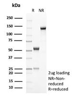 PLA2R1/Phospholipase A2 Receptor 1 Antibody in SDS-PAGE (SDS-PAGE)