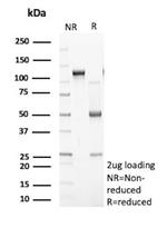 PLA2R1/Phospholipase A2 Receptor 1 Antibody in SDS-PAGE (SDS-PAGE)