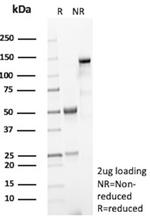 PLA2R1/Phospholipase A2 Receptor 1 Antibody in SDS-PAGE (SDS-PAGE)