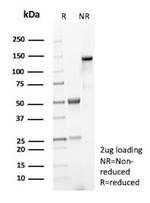 PLA2R1/Phospholipase A2 Receptor 1 Antibody in SDS-PAGE (SDS-PAGE)