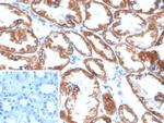 PLA2R1/Phospholipase A2 Receptor 1 Monoclonal Antibody (PLA2R1/4898)