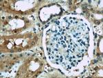ACOT6 Antibody in Immunohistochemistry (Paraffin) (IHC (P))