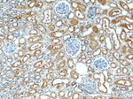 ACOT6 Antibody in Immunohistochemistry (Paraffin) (IHC (P))