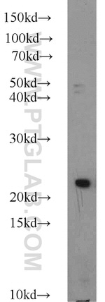ACOT6 Antibody in Western Blot (WB)