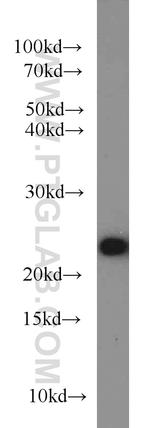 ACOT6 Antibody in Western Blot (WB)