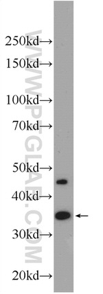 CDX4 Antibody in Western Blot (WB)