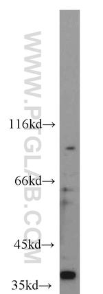 CDX4 Antibody in Western Blot (WB)
