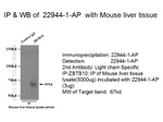 ZBTB10 Antibody in Immunoprecipitation (IP)