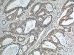 BCL9 Antibody in Immunohistochemistry (Paraffin) (IHC (P))