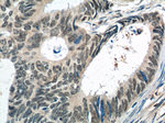 BCL9 Antibody in Immunohistochemistry (Paraffin) (IHC (P))