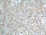 BCL9 Antibody in Immunohistochemistry (Paraffin) (IHC (P))