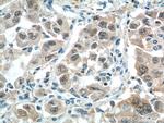 BCL9 Antibody in Immunohistochemistry (Paraffin) (IHC (P))