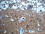 PRODH Antibody in Immunohistochemistry (Paraffin) (IHC (P))