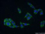 CDKAL1 Antibody in Immunocytochemistry (ICC/IF)