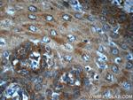 CDKAL1 Antibody in Immunohistochemistry (Paraffin) (IHC (P))