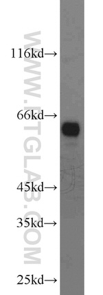 CDKAL1 Antibody in Western Blot (WB)