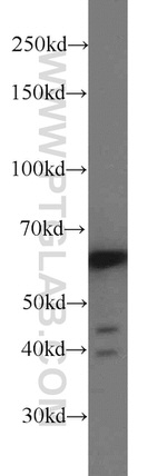CDKAL1 Antibody in Western Blot (WB)