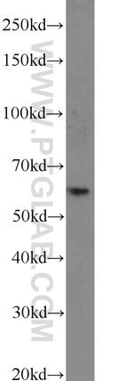 CDKAL1 Antibody in Western Blot (WB)
