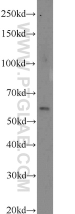 CDKAL1 Antibody in Western Blot (WB)