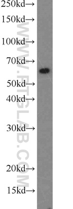 CDKAL1 Antibody in Western Blot (WB)