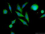 MMP12 Antibody in Immunocytochemistry (ICC/IF)
