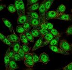 FOXI1/Forkhead Box Protein L1 (Transcription Factor) Monoclonal Antibody (PCRP-FOXL1-1F8)