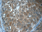 GBP6 Antibody in Immunohistochemistry (Paraffin) (IHC (P))