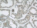 GBP6 Antibody in Immunohistochemistry (Paraffin) (IHC (P))