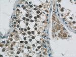 GBP6 Antibody in Immunohistochemistry (Paraffin) (IHC (P))