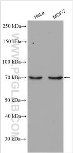 GBP6 Antibody in Western Blot (WB)