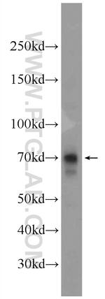 GBP6 Antibody in Western Blot (WB)