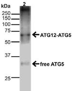 Atg5 Antibody in Western Blot (WB)