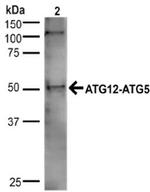 Atg5 Antibody in Western Blot (WB)