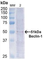 Beclin1 Antibody in Western Blot (WB)